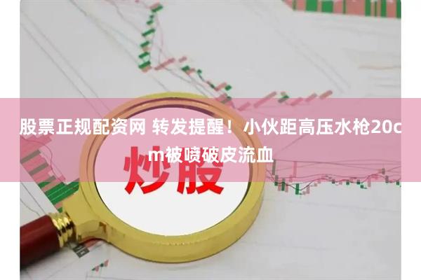 股票正规配资网 转发提醒！小伙距高压水枪20cm被喷破皮流血